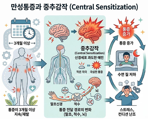 만성통증 키비주얼
