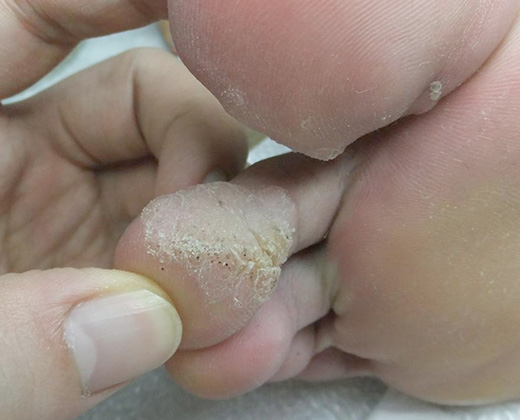 사마귀 키비주얼